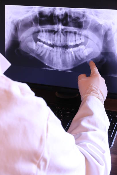 Best Emergency Dental Care for Sports Injuries in Stanley, WI